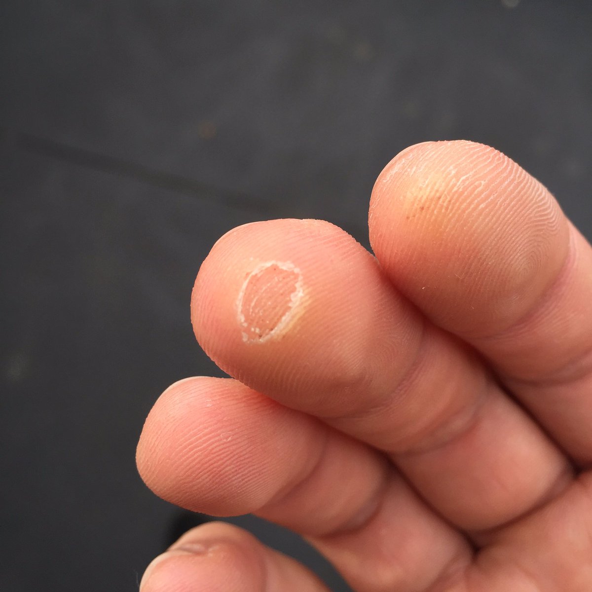 ashbattle's tweet image. .... And a couple of days later