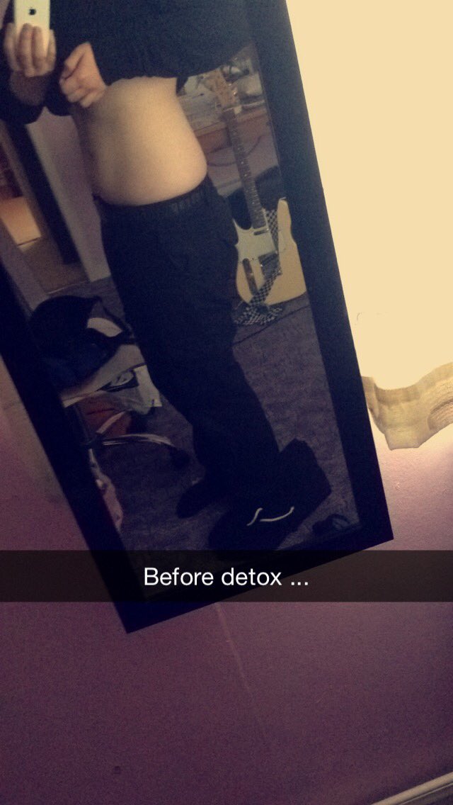 quitleybleeding's tweet image. I don't see a difference lol (excuse the fat)