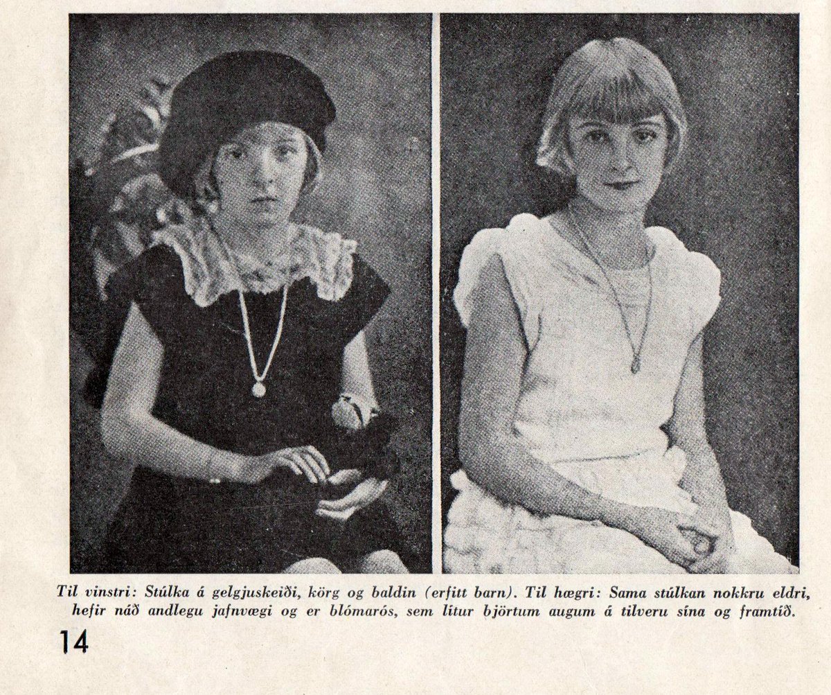 Úr bók Kristínar Ólafsdóttur, læknis og langömmu minnar, Heilsufræði handa húsmæðrum..ég var nkl svona (erfitt barn)