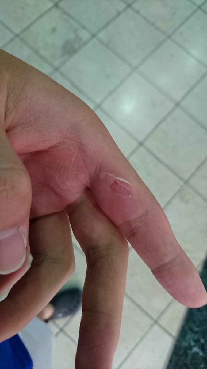 太鼓の達人を久しぶりにしたけど、皮がめくれて凄く痛い