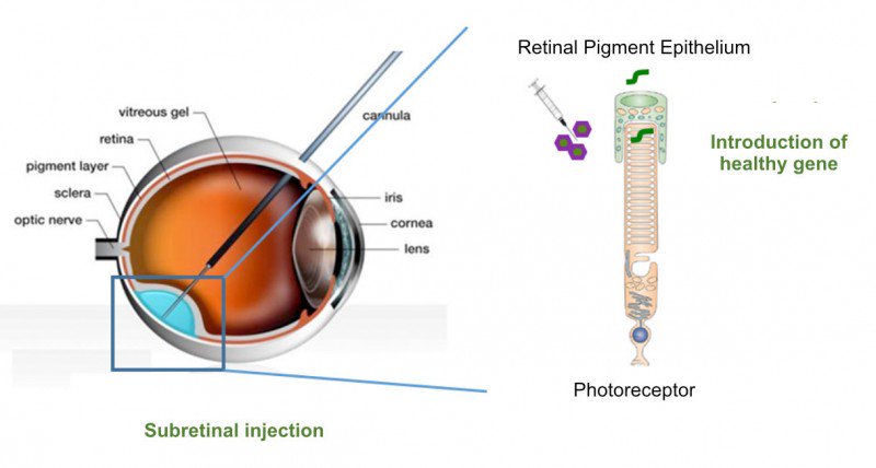 Labiotech_eu's tweet image. French Startup #Horama raised €4M for #GeneTherapy to fix specific Types of #Blindness ow.ly/qXzl3022Vrx