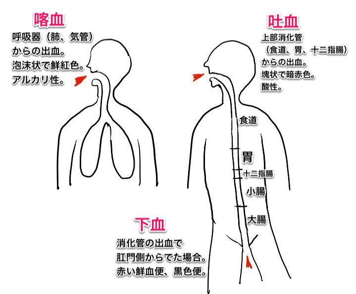 Images of 喀血 JapaneseClass.jp
