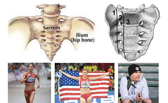 fanhubtf's tweet image. Sacral stress fracture. Some recover stronger than ever (Congrats @emily_infeld!), others... athletebiz.us/blog/sacral-st…