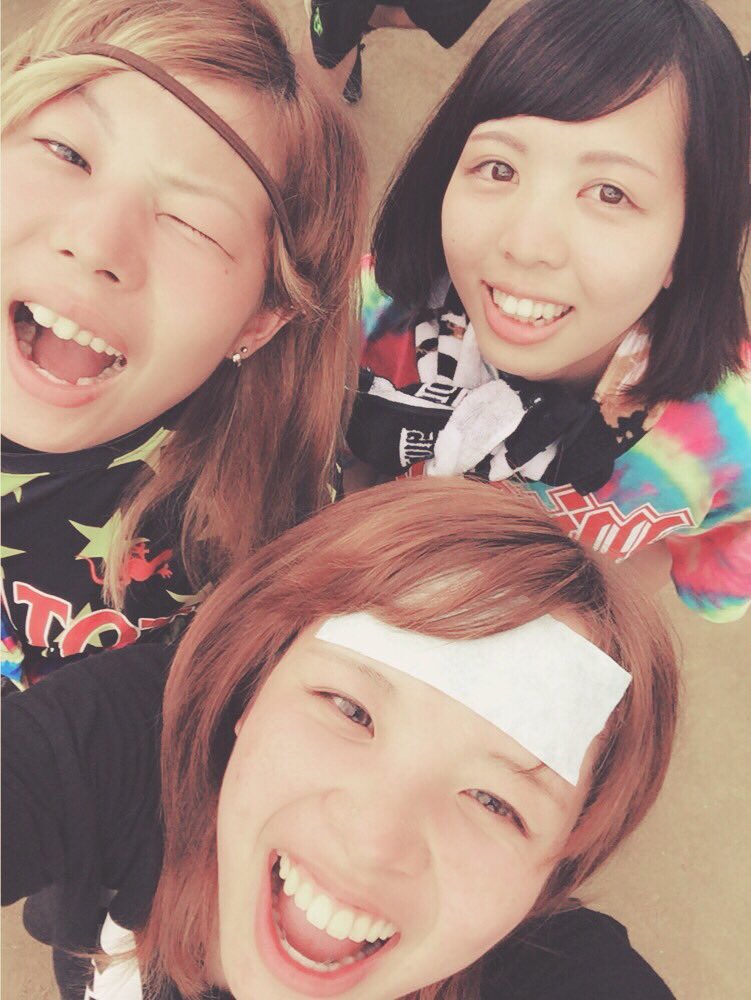 6969akm's tweet photo. 昨日の日焼けで顔が死んでいる。ワニマ超たのしかった〜〜 https://t.co/RmWa3fimfu