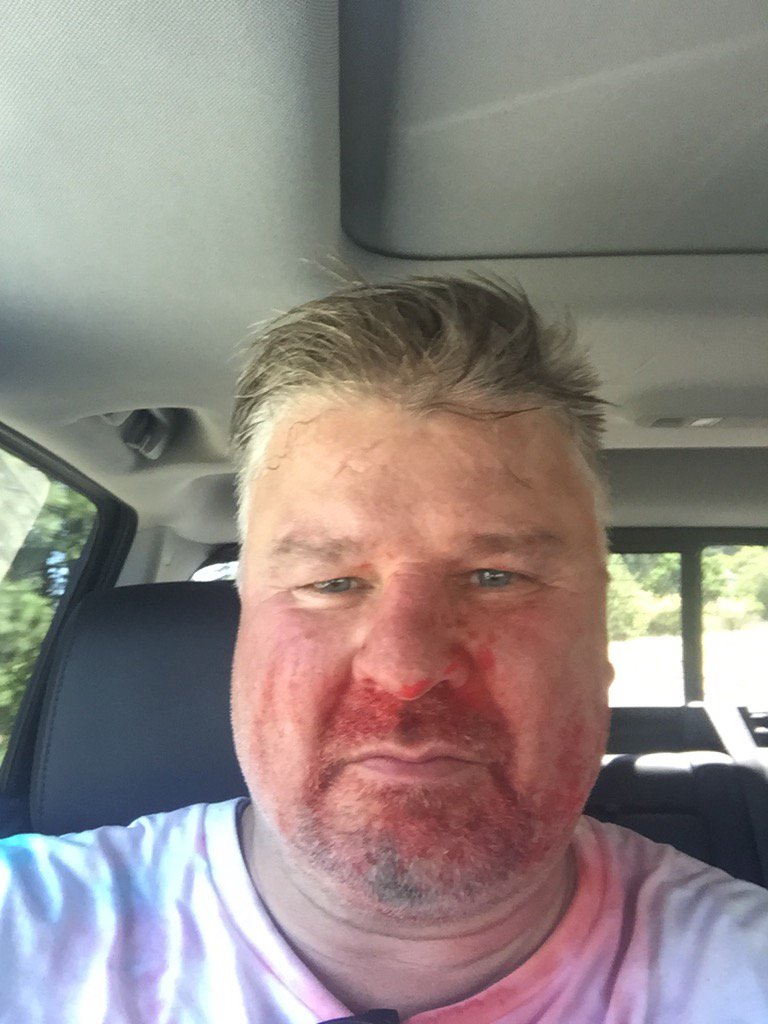 Chasenpucks39's tweet photo. Just finished my first MMA fight at Gozzer #finished3rd https://t.co/C7OvFQe0HK