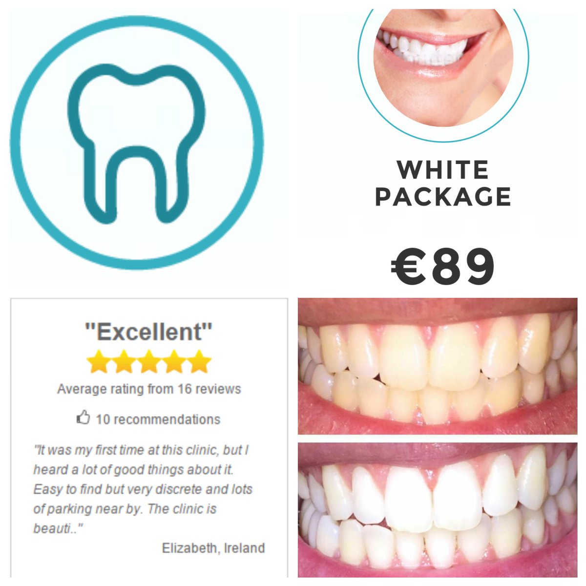 TTWCCork's tweet photo. #whiterteeth is just #1hour . #zerosensitivity #teethwhiteningcork #teethwhiteningcork #whitesmile #corkcity #cork https://t.co/GdXEnowhtE