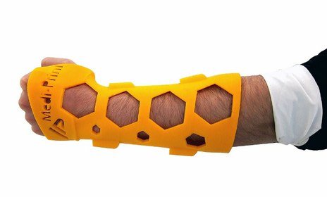 biotechinasia's tweet photo. Will #3dprint casts takeover #plastercast? #NovaCast @UNAM_MX #Mediprint #bonehealing… https://t.co/6aEvxkj1ZS https://t.co/rNw4VkaxGx
