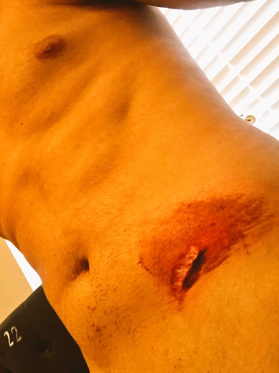 Bradb122's tweet photo. So this happened trying to 12 o clock the 450 https://t.co/1sXQCjMk4h