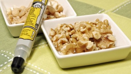CBCKW891's tweet photo. A wallet-sized device will save lives by detecting peanut, gluten allergens in food https://t.co/st2mjSbwlx https://t.co/FnRJCgUY3L