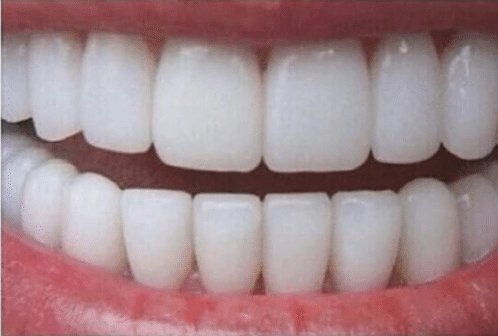 StumblerVideos's tweet photo. If I had this set of teeth I wouldn't even bother talking I'd just smile until I die https://t.co/q4LMAM9BJl