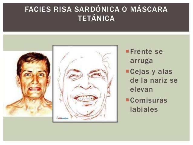 #Dato #Micro #ClostridiumTetani