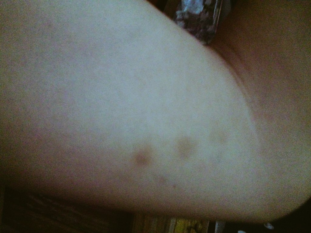 itseribitch's tweet photo. Las tres Marías en versión moretones #polekisses #polebruises #polesport https://t.co/IgIBffOaYM