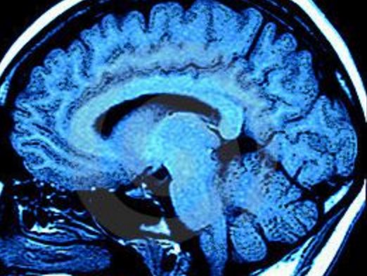 “Brain Imaging of Pain Brings Success to Disability Claim”

bit.ly/29iHdJH

#RSD #CRPS