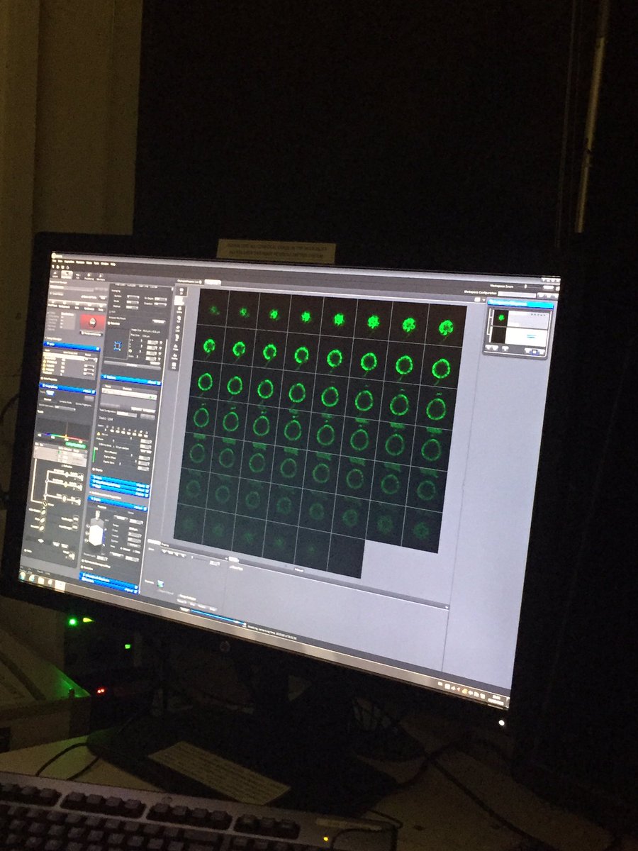 Rioannon's tweet photo. 3D imaging using confocal microscopy real prehistoric pollen grains! 3D printed for outreach purposes. Pretty cool! https://t.co/cydcVO5W2u