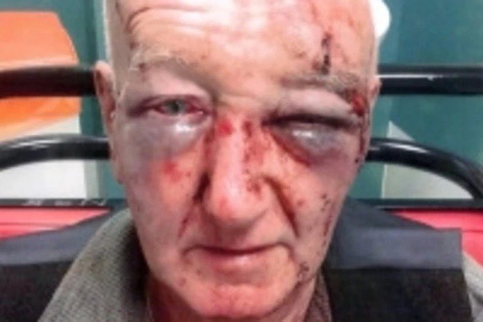 NATIONAL NEWS: Pensioner attacked after asking man to stop urinating on partner's house
trib.al/Lh7qXA8