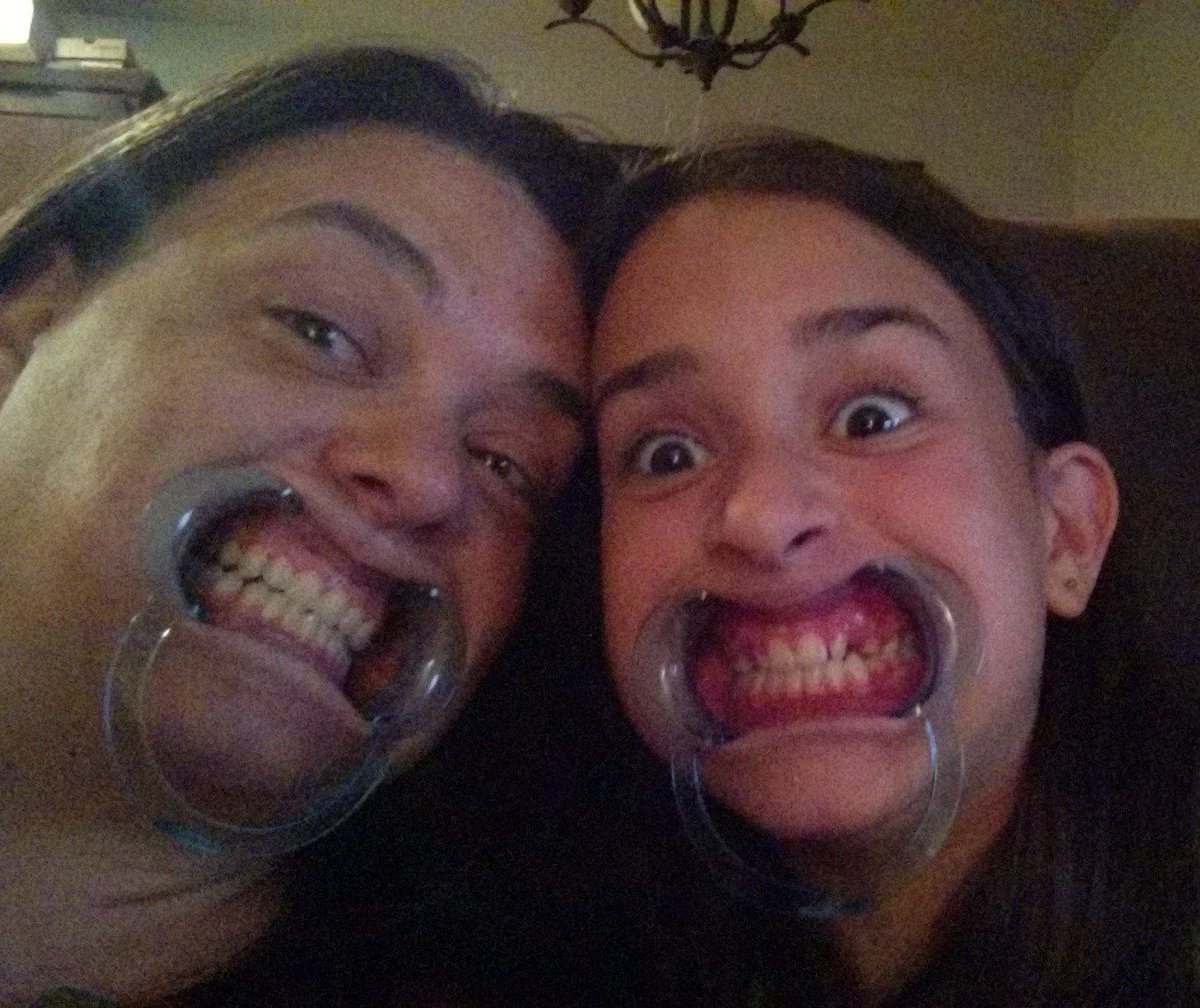 AccredRolson2's tweet photo. took the #cheekspreader home... so much fun #mootmouth #mtmoot #moonami https://t.co/hyCajkJ3Yz
