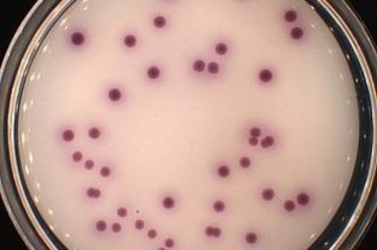 ScienceDaily's tweet photo. Vibrio Bacteria Hitchhiking Sea to Sea On Plastic https://t.co/FvfCs9QSzt https://t.co/UKWUubIiSs