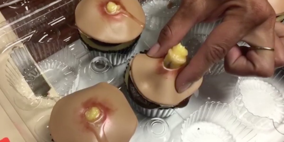 HuffPost's tweet photo. SCREAMING at these hyper-realistic pimple cupcakes (kinda NSFW, tbh) https://t.co/hmhZ5zS2U6 https://t.co/7N45PNNIV5