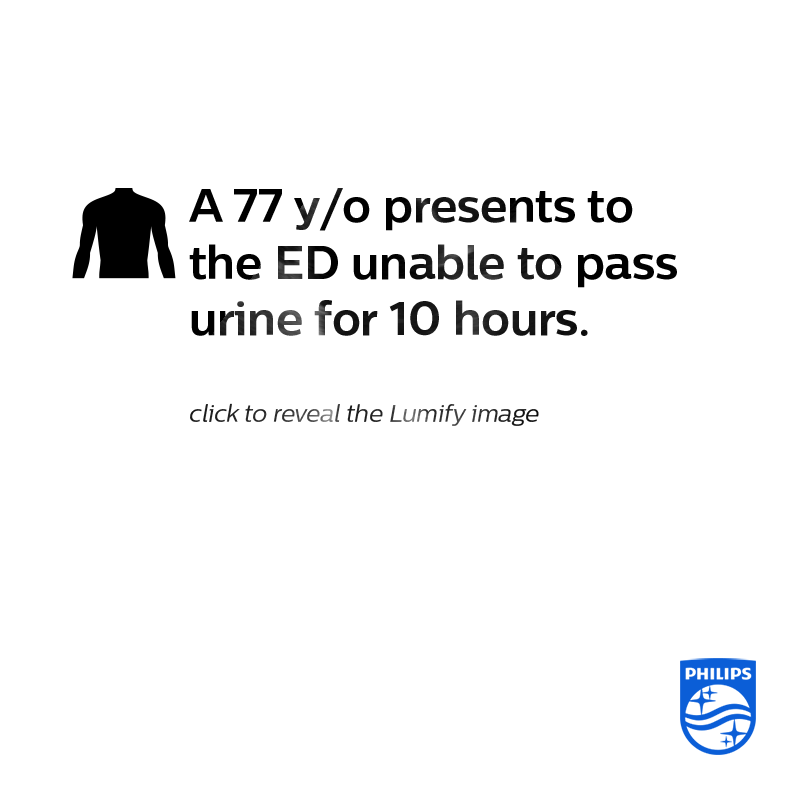 PhilipsPOCUS's tweet photo. #ClickToReveal the #PhilipsLumify image. https://t.co/StH8eRVd4z