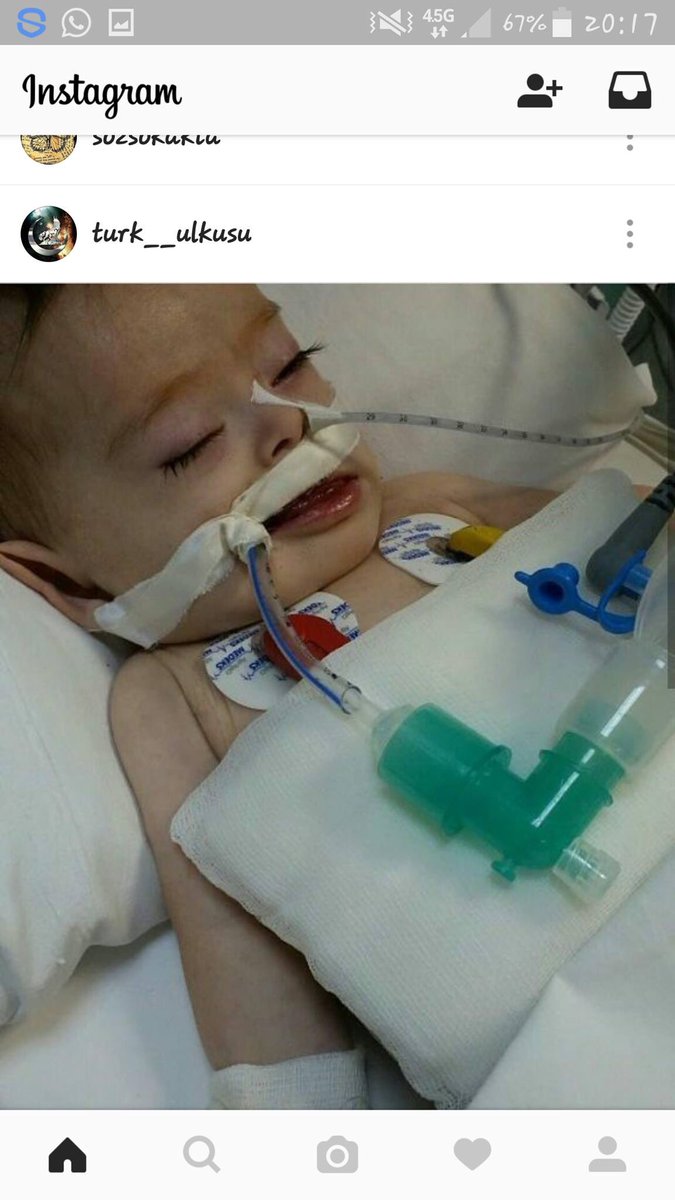 Dede38__'s tweet photo. ALLAH AŞKINA BU TWEET'İ GÖREN HERKES RT YAPSIN !!!!

AİLE 1 AYDIR HASTANEDE 20 ÜNİTE KAN LAZIM VE ŞU AN 6 ÜNİTE VAR! https://t.co/yRHTExP7vR