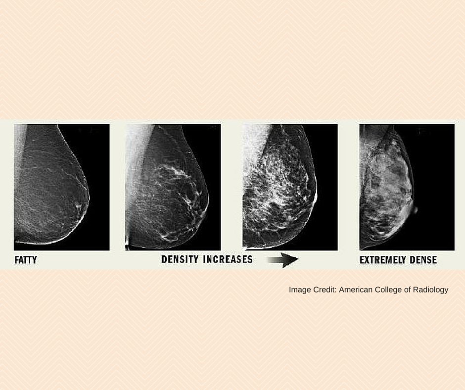 SureTouch BreastExam tweet media