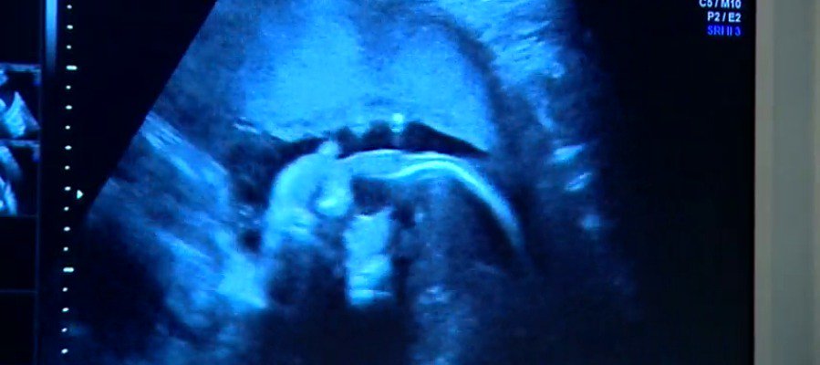 A3Noticias's tweet photo. Cataluña podría prohibir adopciones de países del Este por casos de “alcoholismo fetal” https://t.co/BC2fKCjsyE https://t.co/NpwZpis4EH