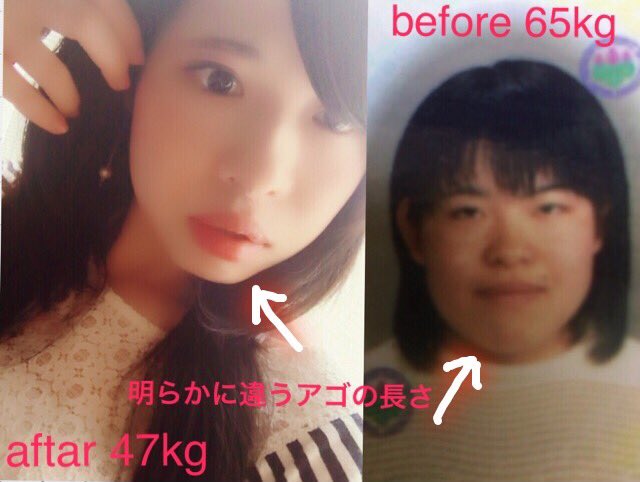 ট ইট র 千 産後ダイエット 昔の私の写真を幼馴染たちとまた見返して 唇からアゴの長さが違うと整形疑惑が 笑 あのね2人共 太りすぎでアゴ下の肉が見えてるだけです W お肉で首がなかったって事です ダイエット垢 ダイエット仲間募集