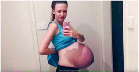 ltsMindblowing's tweet photo. Mom Finds A Photo Of Her Pregnant Belly. When She Looks Closer, She Can't Even Believe It

 https://t.co/9YZ7FCbsIo https://t.co/ClkLCwFE7k