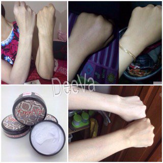 ViNdsShop's tweet photo. New Produk dr DeeVa Derma Soft Skin, WBC 50gr. DiJamin kulit bakalan blink2. Info order pin:2B105C3C WA:081252848884 https://t.co/9mOgPVcNWZ