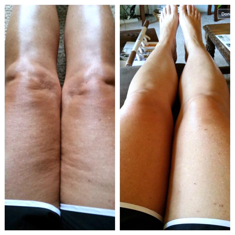 realashleyblack's tweet photo. Blast away #cellulite with the #FasciaBlasterยฎ & improve your physique! Get it here: https://t.co/ynLcgrzDmF https://t.co/IU1ZVYXi74