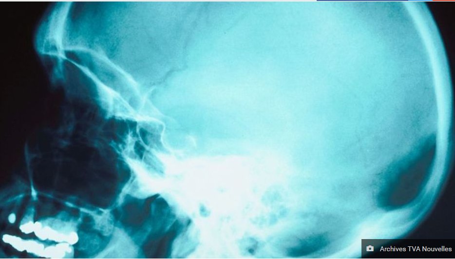 Alzheimer Montréal tweet media