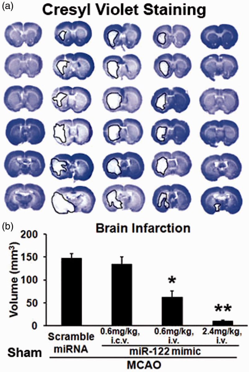 _JCBFM's tweet photo. ↑ miRNA-122 in blood improves outcomes after tMCAO in rats https://t.co/bXB7fg8Dom #SageChoice #HotTopics https://t.co/ZnlPic44zP