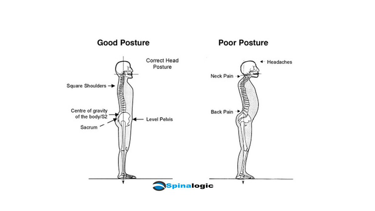 spinalogicbali's tweet image. Have your posture checked at Spinalogic today.
Call +628113980811
#spinalogic #health #bali #indonesia