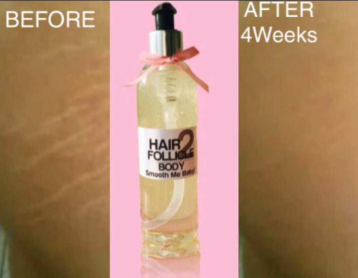 Hair2Follicle1's tweet photo. π Smooth Me Babyπ
Banish cellulite & stretch marks with this wonderlust body oilπ±
#Anticellulite+ #AntiStretchMark+ https://t.co/gYSMjPjS9O