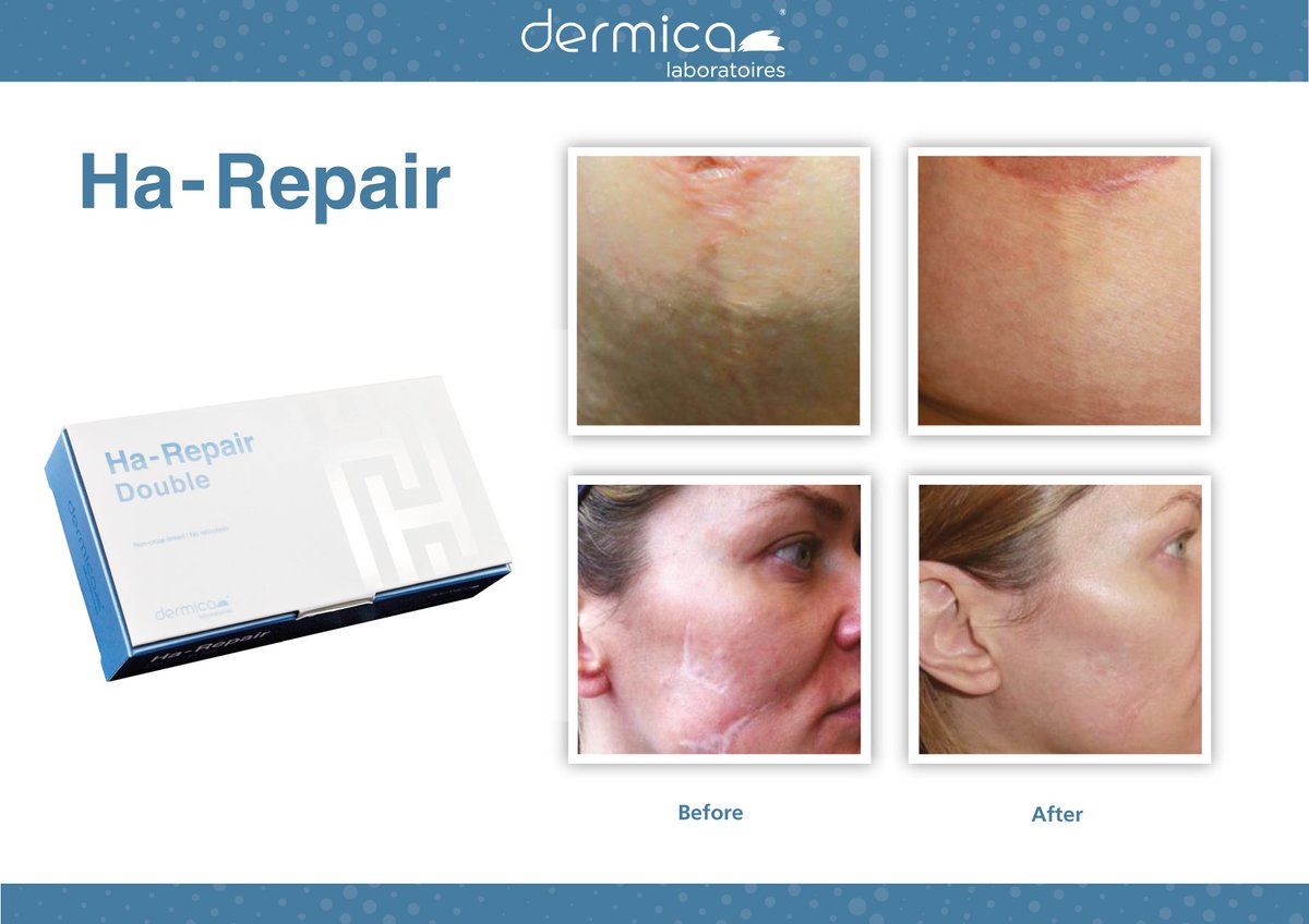 HA - REPAIR DOUBLE is a mixture consisting of the combination of two types of hyaluronic...
dermica.ch/en/prod_446_42…