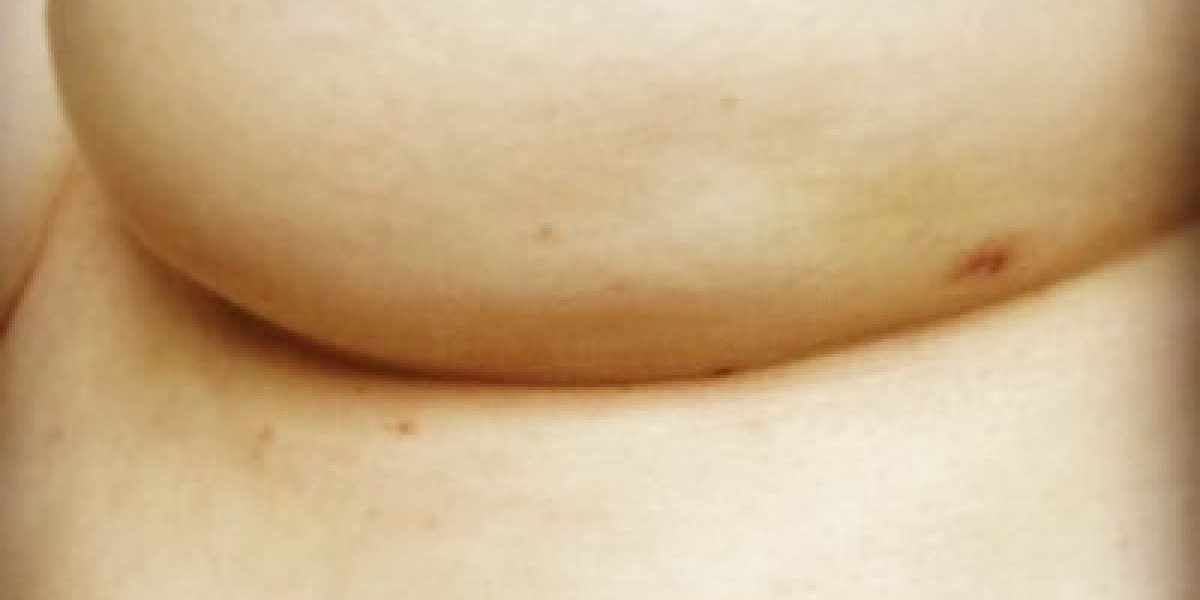 HuffPostCanada's tweet photo. When doing a self breast exam, don't forget to #checkforthedimple https://t.co/HE7M6RwMwR https://t.co/zDqUWoMSBU