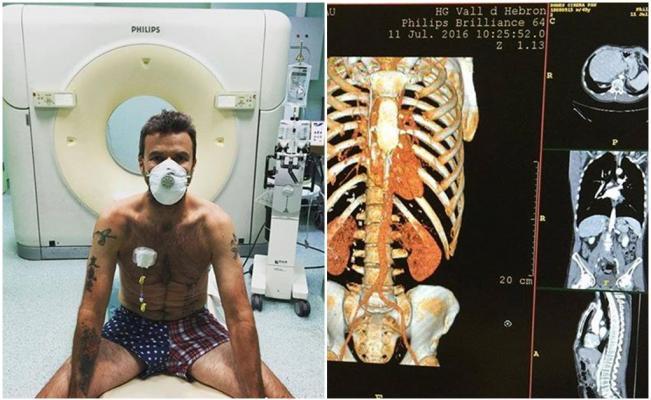 El_Universal_Mx's tweet photo. Vocalista de Jarabe de Palo, limpio de cáncer; Pau Donés compartió la noticia en redes https://t.co/7919NBgCDM https://t.co/fZNculso30