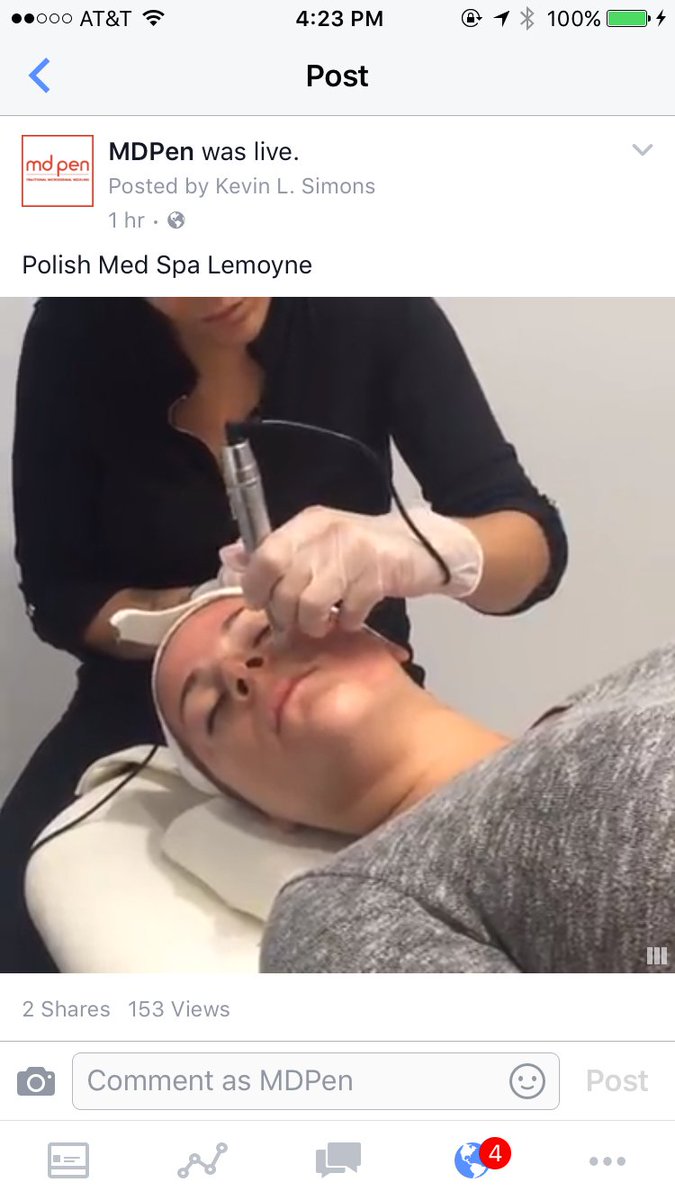 sociableaesthet's tweet photo. MDPen #microneedling was LIVE on Facebook.  Watch here.  https://t.co/TN10U3rhbm https://t.co/TKnEgFa5vP