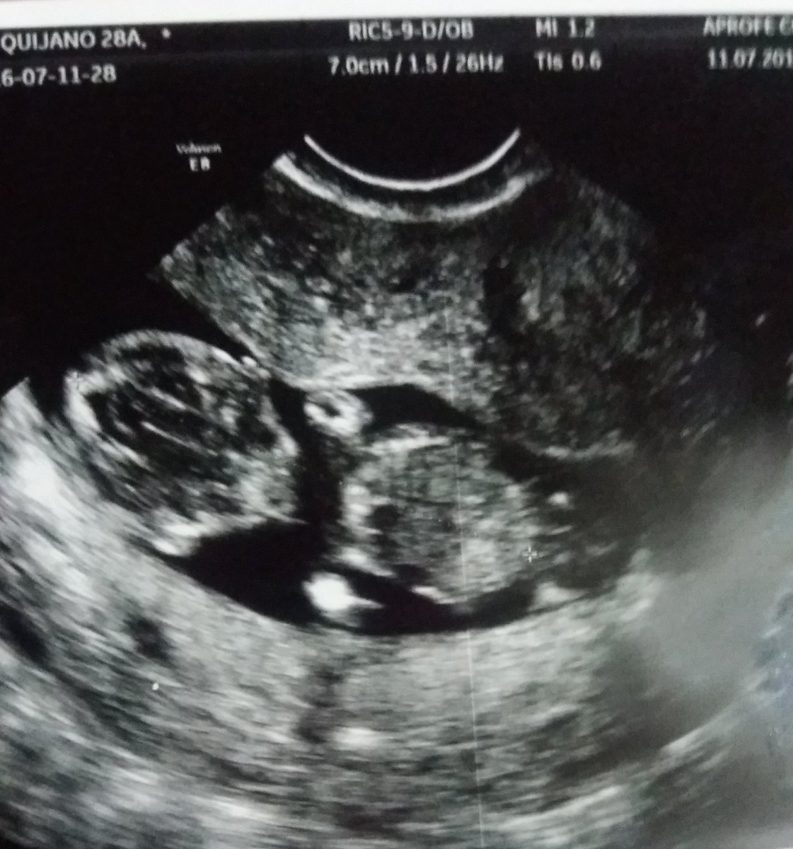 mari_azul87's tweet image. #mibebe #tagrande #ternuritademami #😍