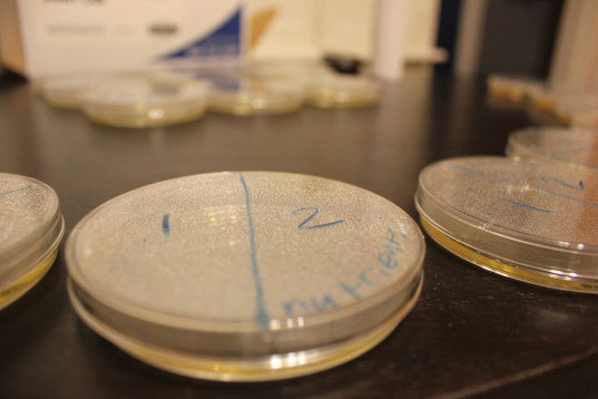 DaftasView's tweet photo. Rare Plastic-Eating Fungus in the discovered in Ecuadorian Rainforest https://t.co/UDvWPyAnYy https://t.co/hbie6RIwaO