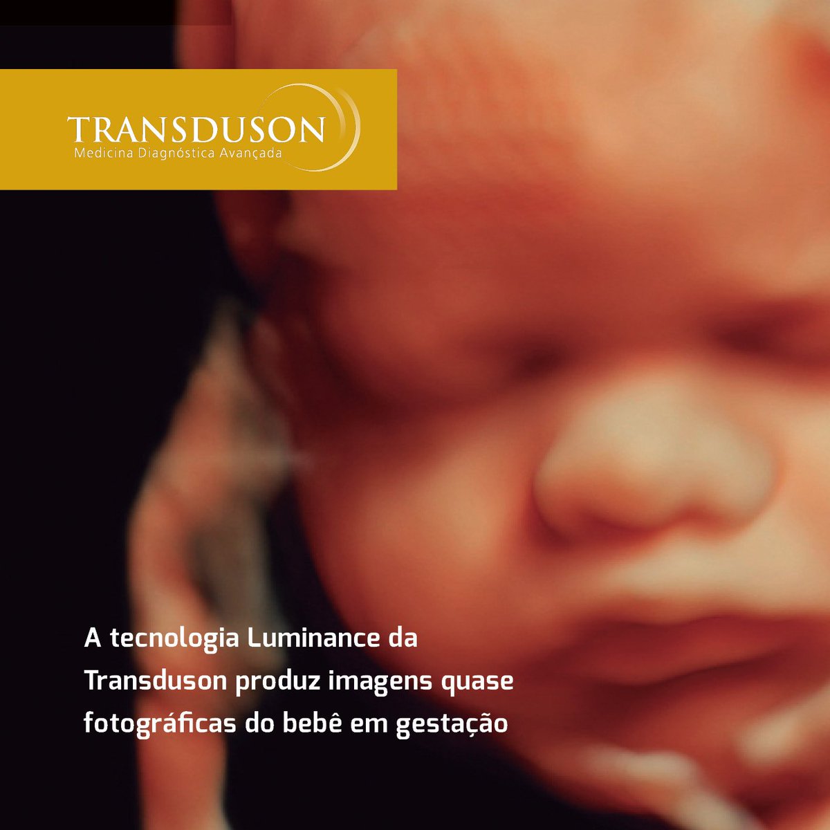 transduson tweet picture