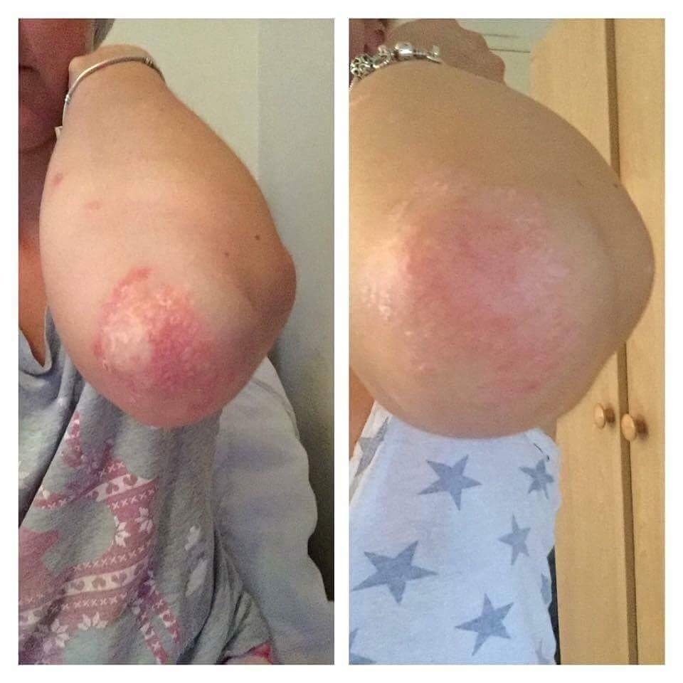 EmmaCorcoran89's tweet photo. #4weeks 😲

#Berries 🍇🍇 &amp;  #shakes 🍶🍶

Pop me a 💌 to get your own results 😙 https://t.co/HOOeoh3M43