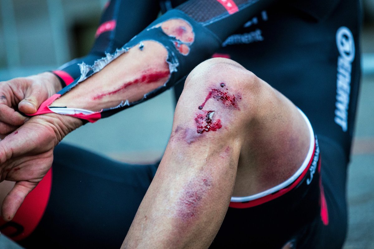 LiamStones's tweet photo. Fuming to crash again today after being out in the break all night! Both hips done and a wrecked finger! 👌🏼MEGA! https://t.co/y3EliUJjwz