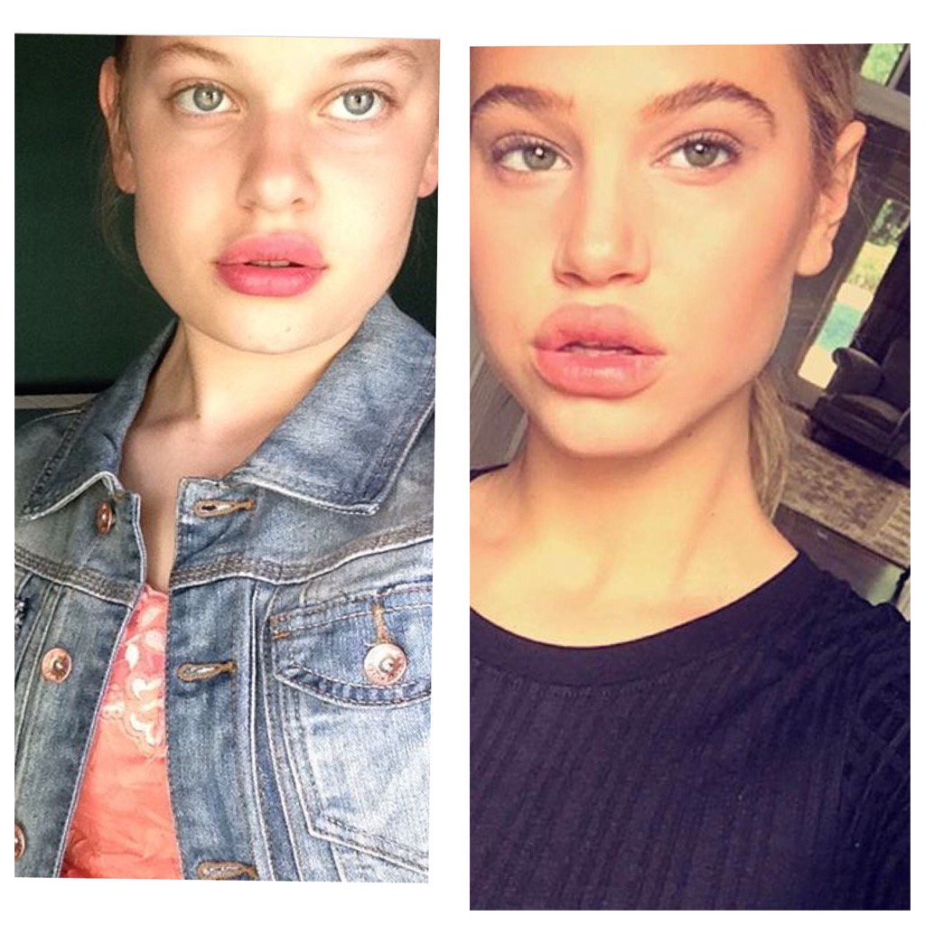 Marissa Lenzini tweet media