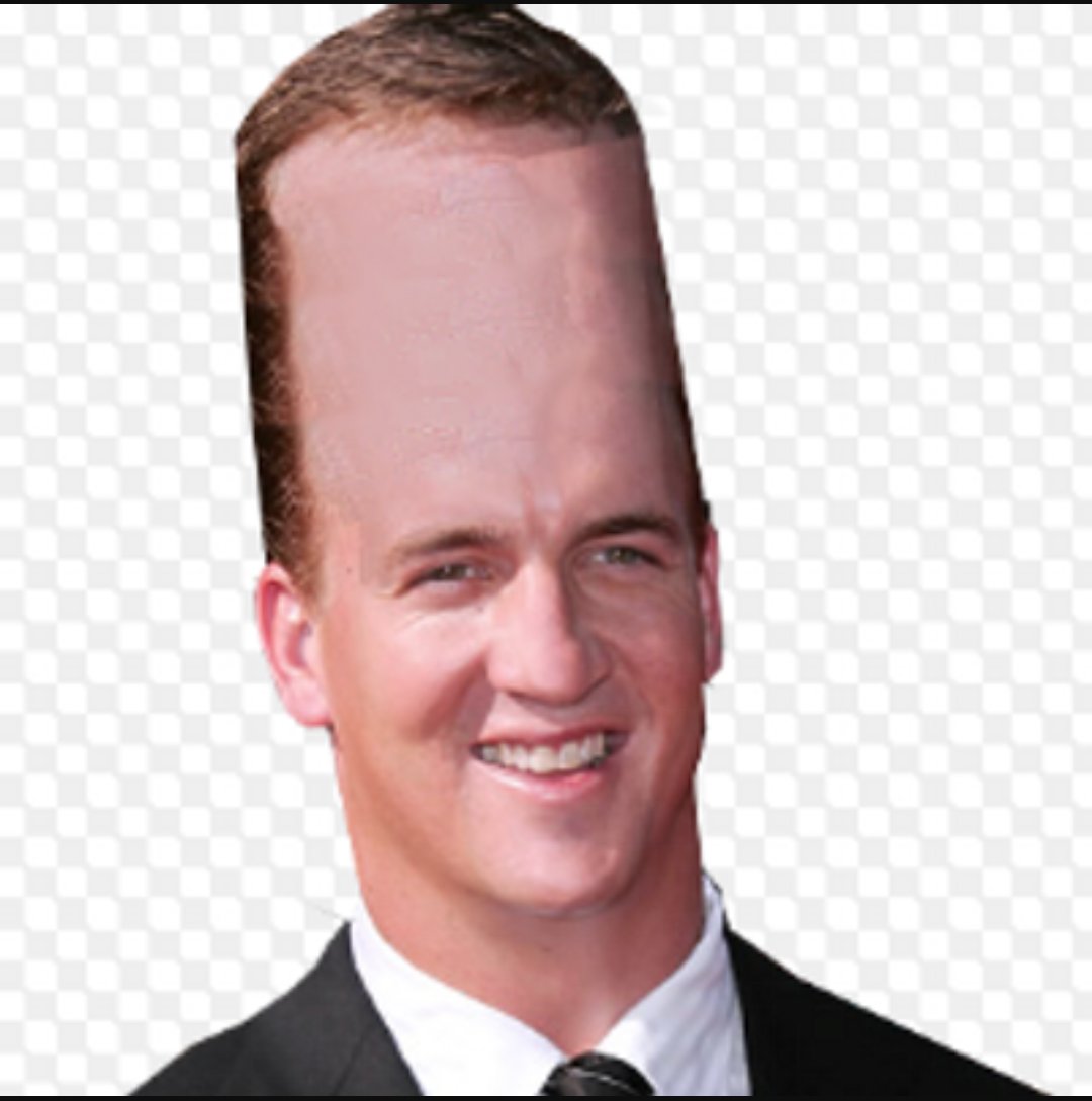 Worlds Biggest Forehead