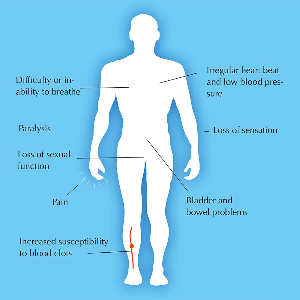 t's important that people with and without a #sci are educated about the side effects this condition can cause.