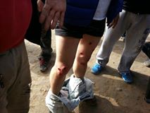 NoticiasdeAR's tweet photo. JUJUY. Brutal represión de la policía provincial contra los Trabajadores azucareros del Ingenio Ledesma de Blaquier. https://t.co/3dk4ddtwxu