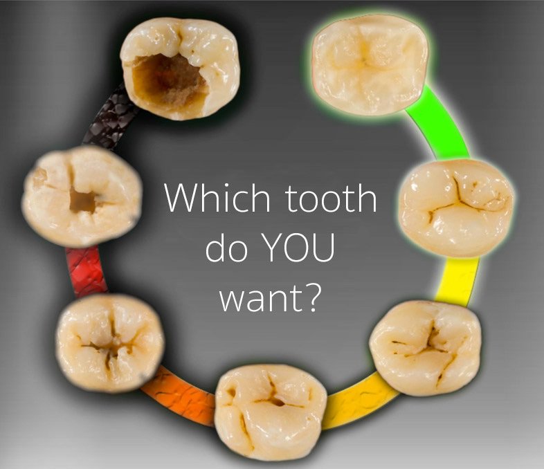 ProfessionalDDS's tweet image. Candy that really fights cavities bit.ly/1UDekgj