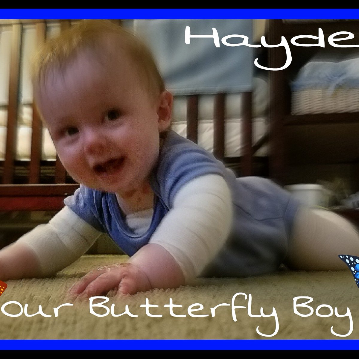 NicoleEsser1's tweet photo. Our little butterfly baby! EB won't stop him!#cureEB  #prayersforbabyhayden #irefuseEB # https://t.co/gL7RExMSYI