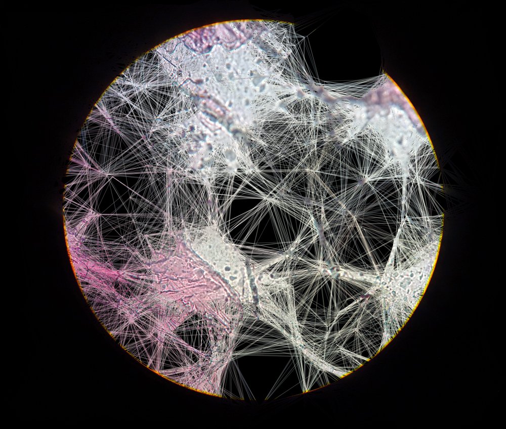 dantappersound's tweet image. Micro Test #1 - Onion skin under microscope + augmented by code. #sciart